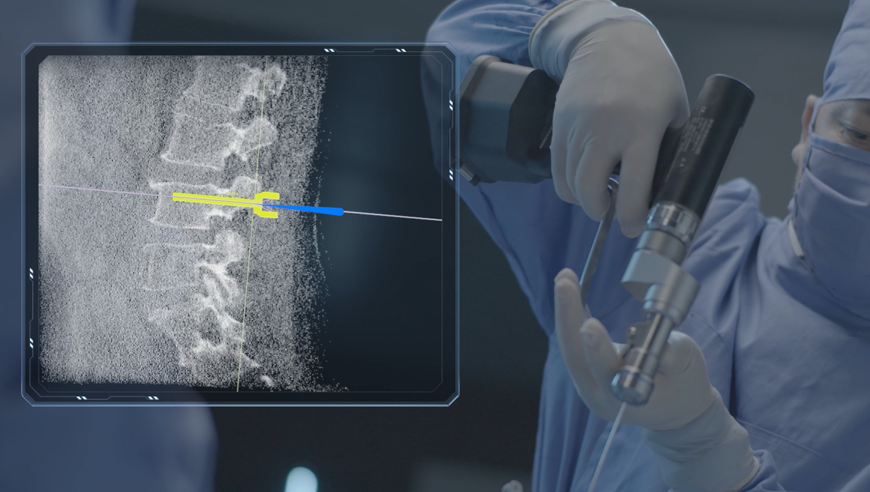 机器人做手术好还是医生做手术好，机器人做手术有哪些好处？