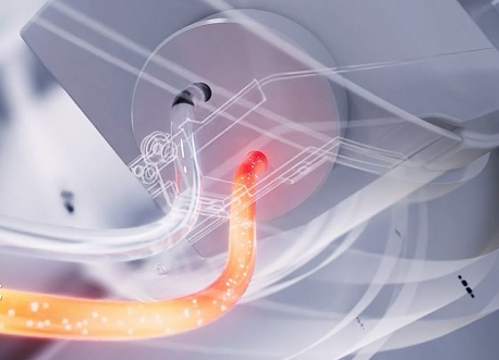 X线球管热容量是越大越好吗？