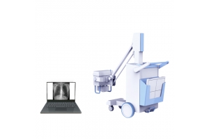 移动式摄影X射线机PLX5100 移动式摄影X射线机PLX5100