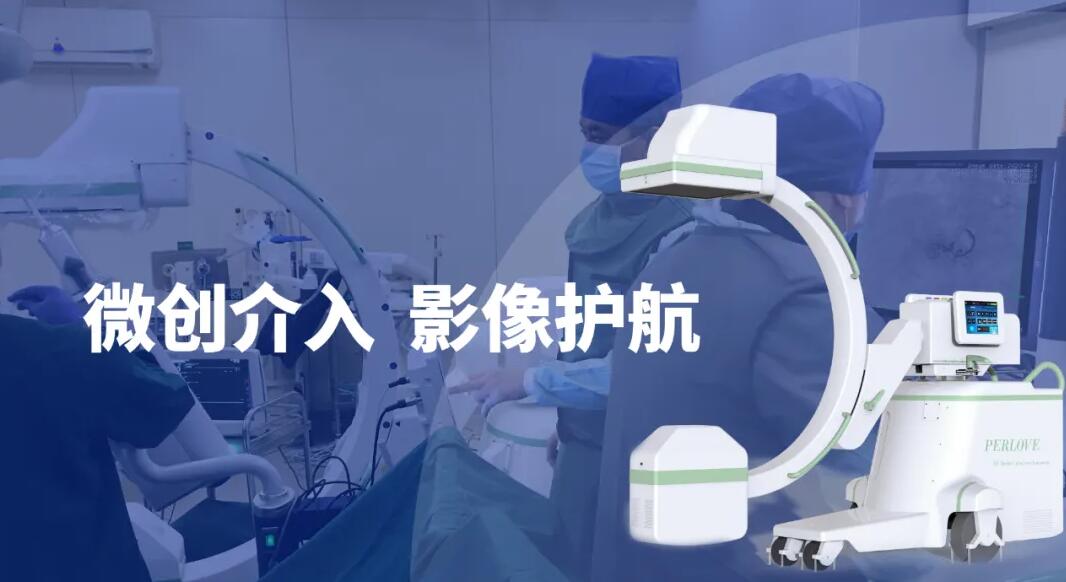高清影像介入c臂机助力微创介入手术更成功 高清影像介入c臂机助力微创介入手术更成功