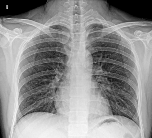 临床图像 临床图像