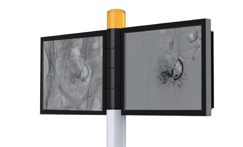 PLX7100A介入C形臂显示器 PLX7100A介入C形臂显示器