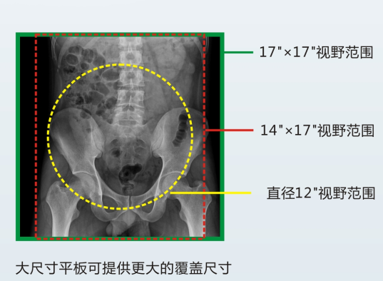动态DR成像视野 动态DR成像视野