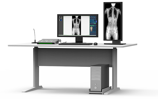 动态DR机大视野成像 动态DR机大视野成像