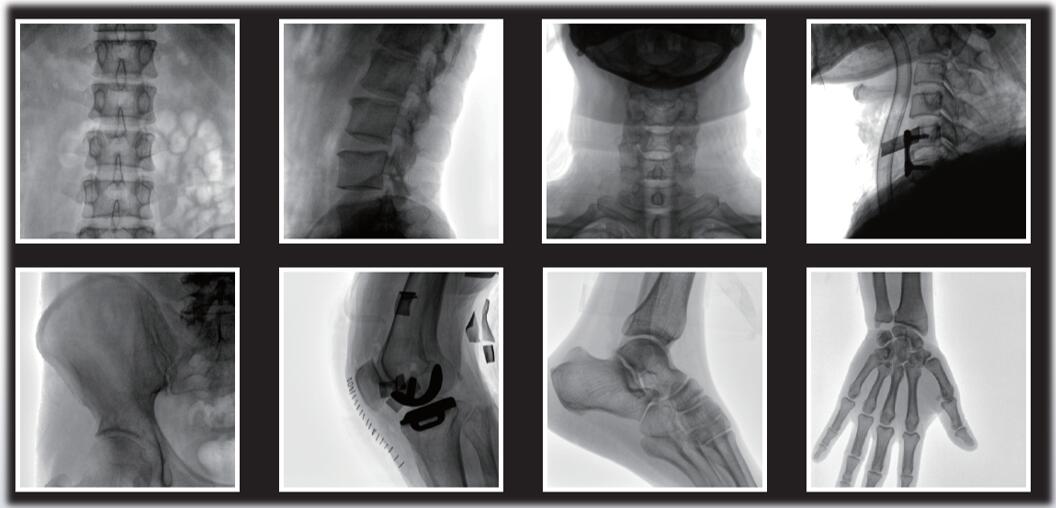 平板小C臂临床影像 平板小C臂临床影像