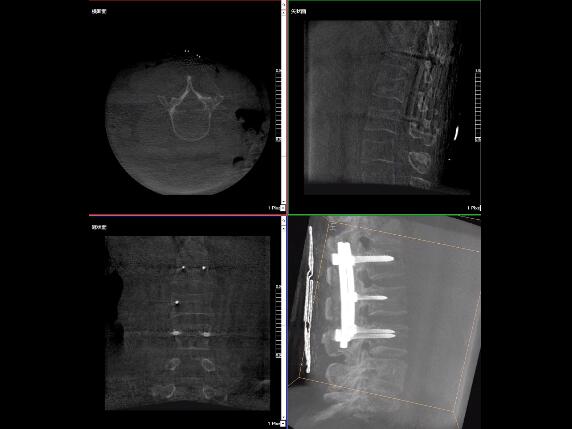 【医疗科普】2分钟带你了解高质量X光片的标准是什么？