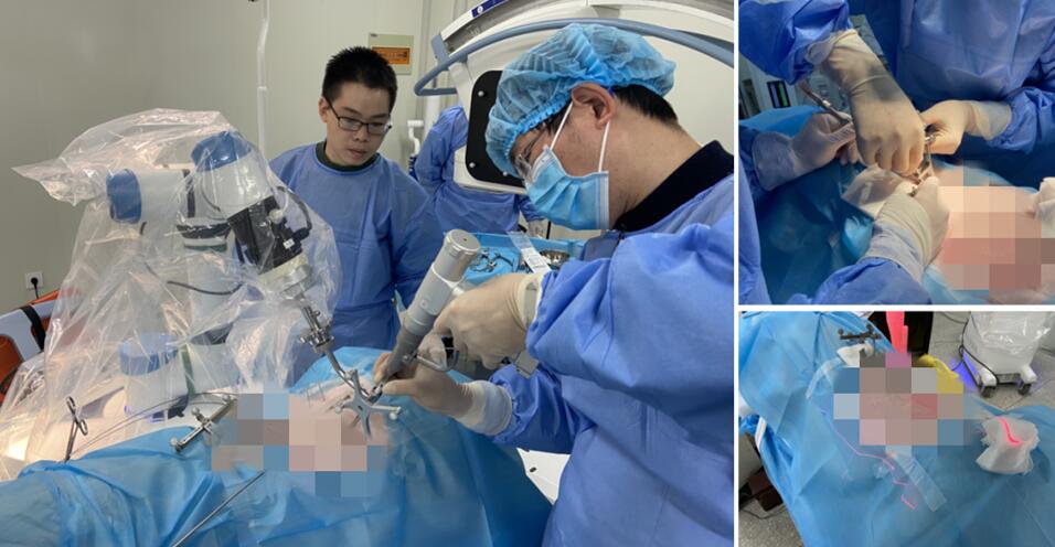 骨科手术机器人助力微创 骨科手术机器人助力微创