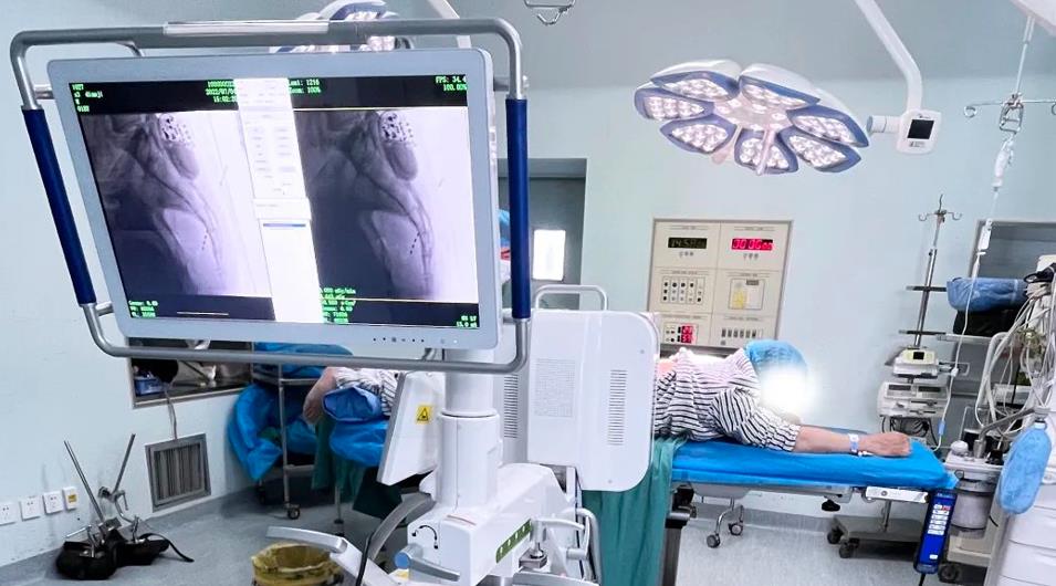 一体式移动C形臂影像 一体式移动C形臂影像