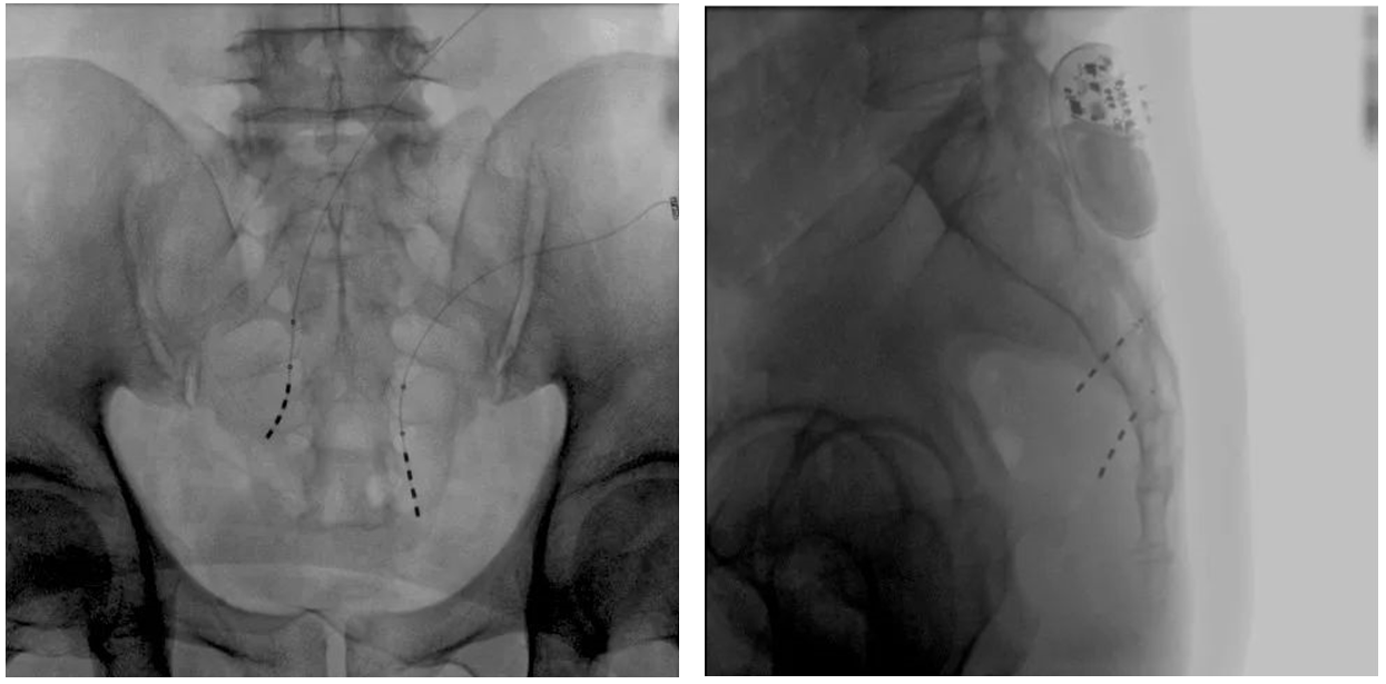 大平板一体式移动C形臂术中影像 大平板一体式移动C形臂术中影像