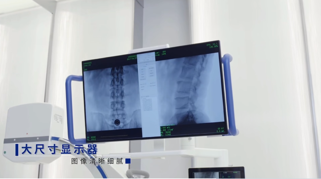 一体式移动C形臂大尺寸显示器 一体式移动C形臂大尺寸显示器