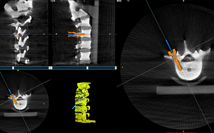 机器人手术系统3D影像 机器人手术系统3D影像