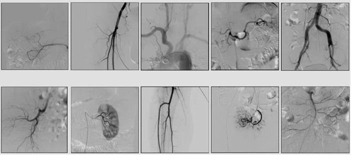 中C临床影像 中C临床影像