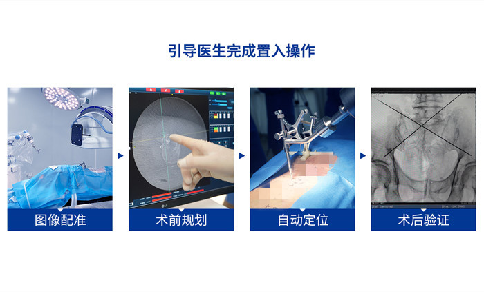 手术机器人优点 手术机器人优点