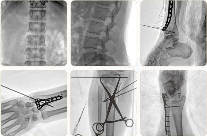 移动式平板C形臂  移动式平板C形臂