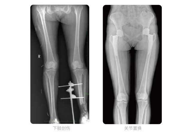 动态数字化X线摄影(动态DR)成像 动态数字化X线摄影(动态DR)成像