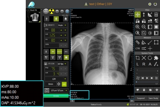 标配DAP功能 标配DAP功能