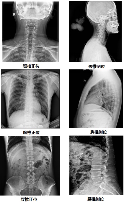 固定悬吊dr-PLD7800E部分临床效果图 固定悬吊dr-PLD7800E部分临床效果图