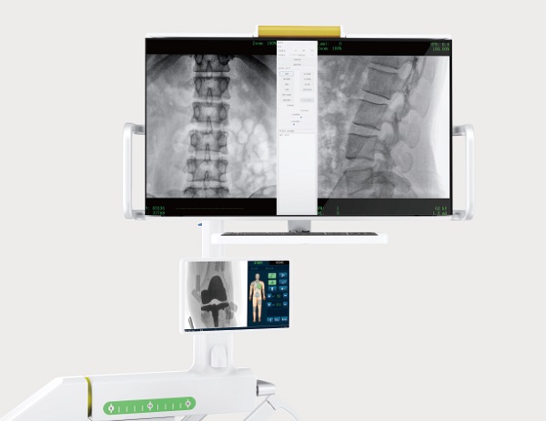 智能图像处理技术 智能图像处理技术