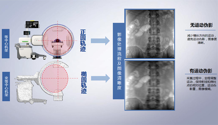 三维C臂的机架设计 三维C臂的机架设计