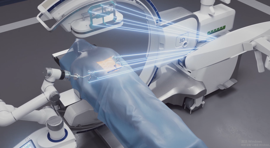 骨科手术导航定位系统 骨科手术导航定位系统