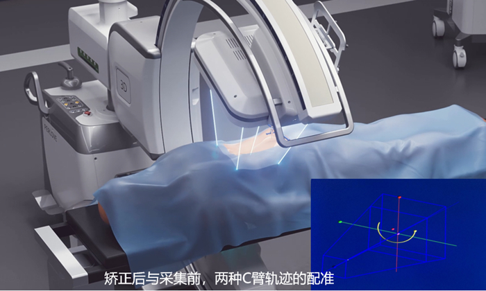 骨科手术导航定位系统 骨科手术导航定位系统