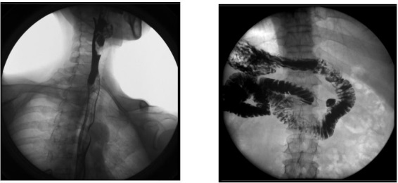 平板数字胃肠机临床影像 平板数字胃肠机临床影像