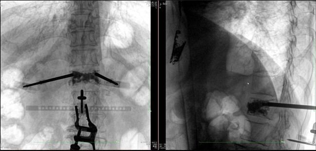 骨科机器人影像 骨科机器人影像