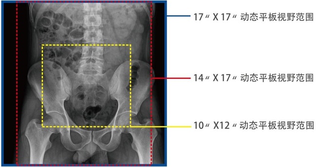 动态DRF的平板 动态DRF的平板