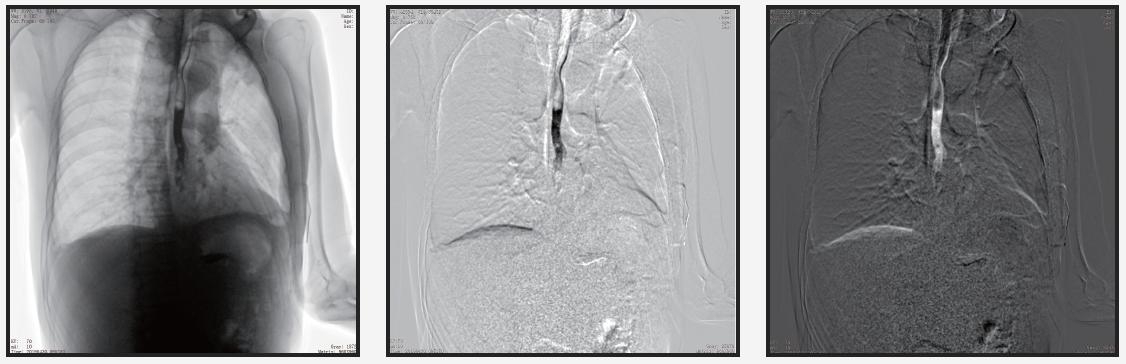 动态dr影像 动态dr影像