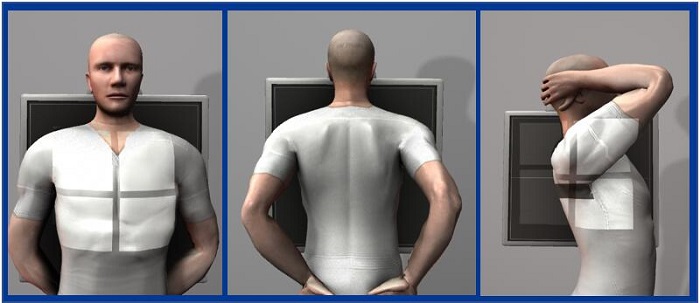 悬吊dr3D摆位指示 悬吊dr3D摆位指示