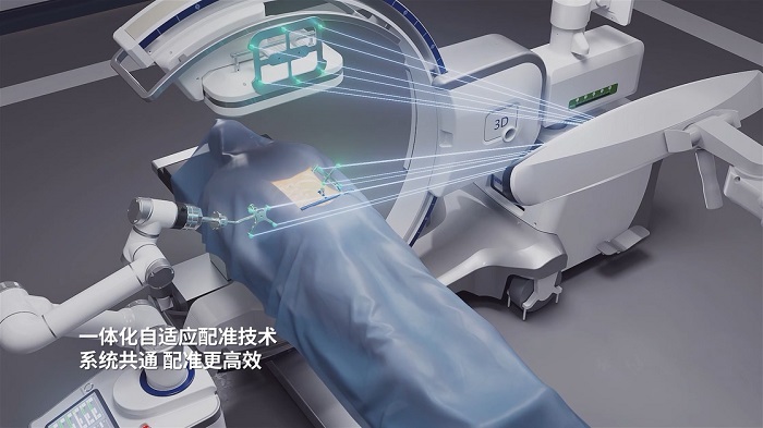 脊柱手术机器人一体化自适应配准技术 脊柱手术机器人一体化自适应配准技术