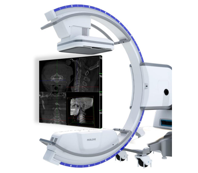术中三维成像 术中三维成像