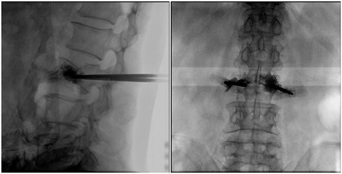 大平板C臂机的高清图像 大平板C臂机的高清图像