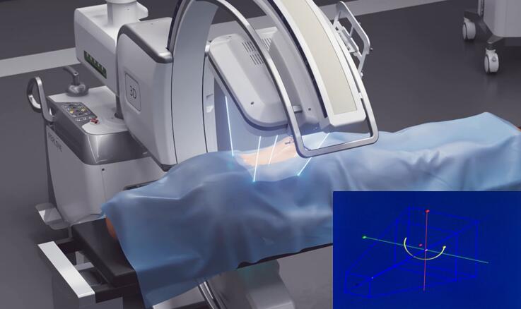 自适应配准(轨迹配准) 自适应配准(轨迹配准)