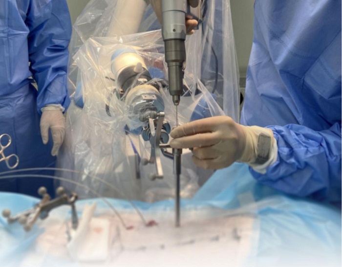 手术机器人的导航和定位 手术机器人的导航和定位