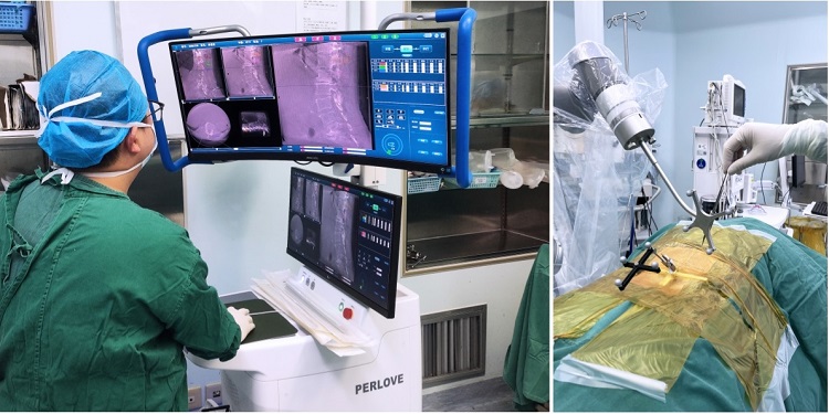 普爱骨科手术机器人 普爱骨科手术机器人