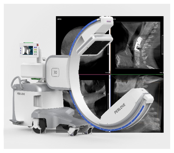 骨科C臂X光机 骨科C臂X光机