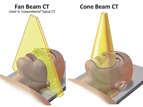 C臂CT和普通CT的成像技术对比 C臂CT和普通CT的成像技术对比