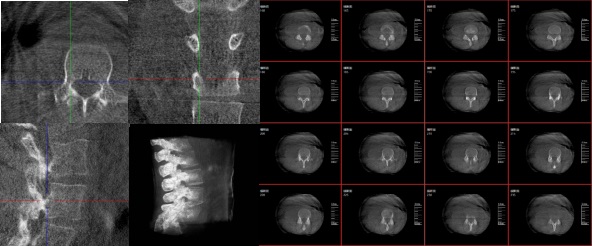 三维重建技术影像 三维重建技术影像