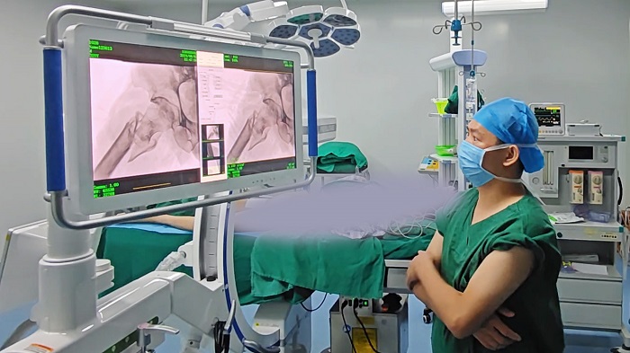 一体式移动C型臂 一体式移动C型臂