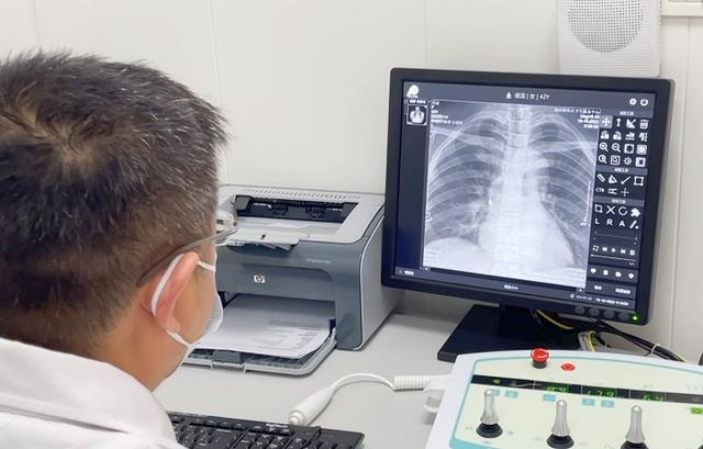 胃肠造影机的人员配置 胃肠造影机的人员配置