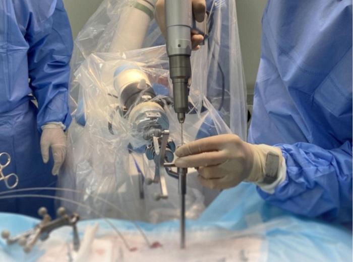 脊柱外科手术导航定位系统 脊柱外科手术导航定位系统