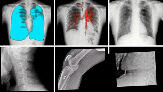 动态DR影像 动态DR影像
