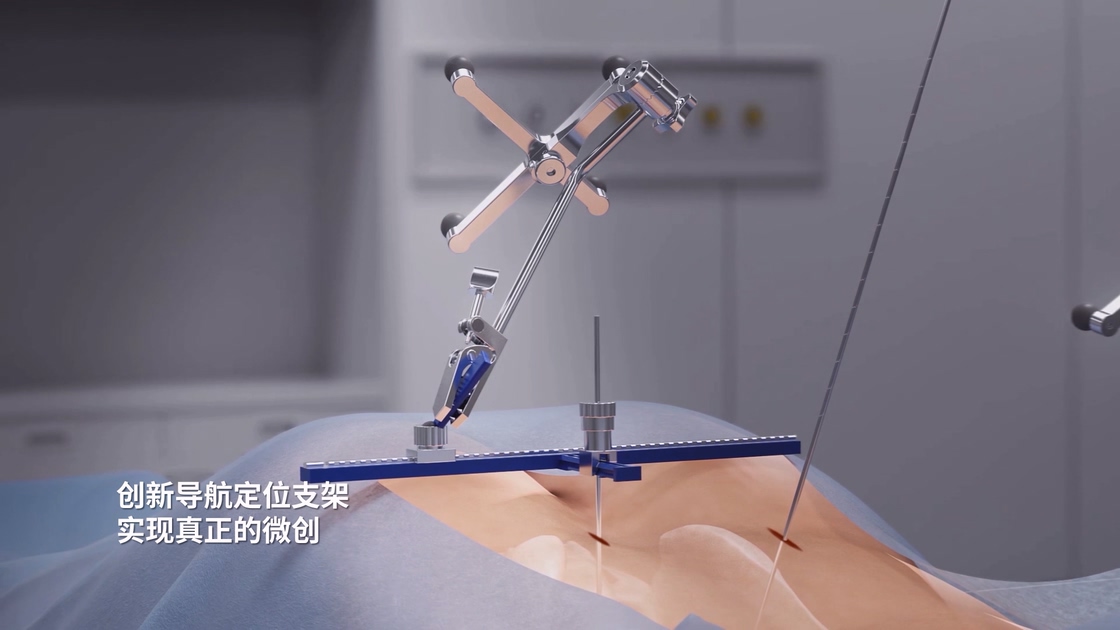 骨科手术机器人导航定位支架 骨科手术机器人导航定位支架