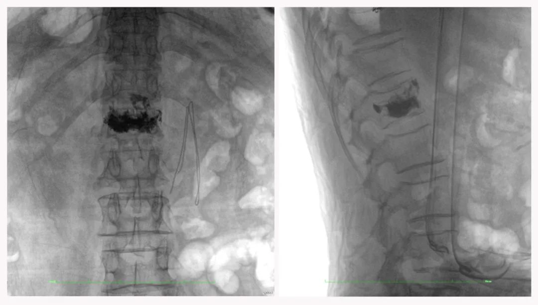 二维C形臂图像 二维C形臂图像
