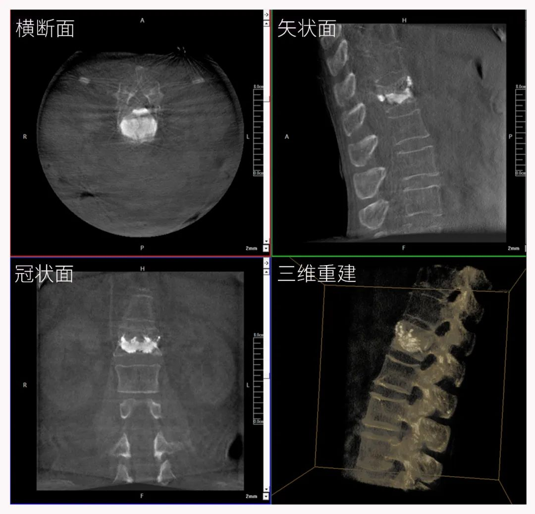 三维C形臂图像 三维C形臂图像