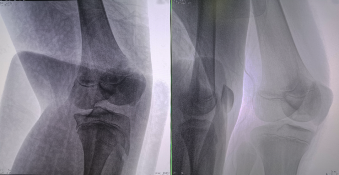 二维C形臂图像 二维C形臂图像