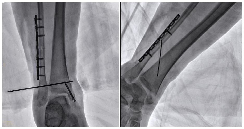 二维C形臂图像 二维C形臂图像