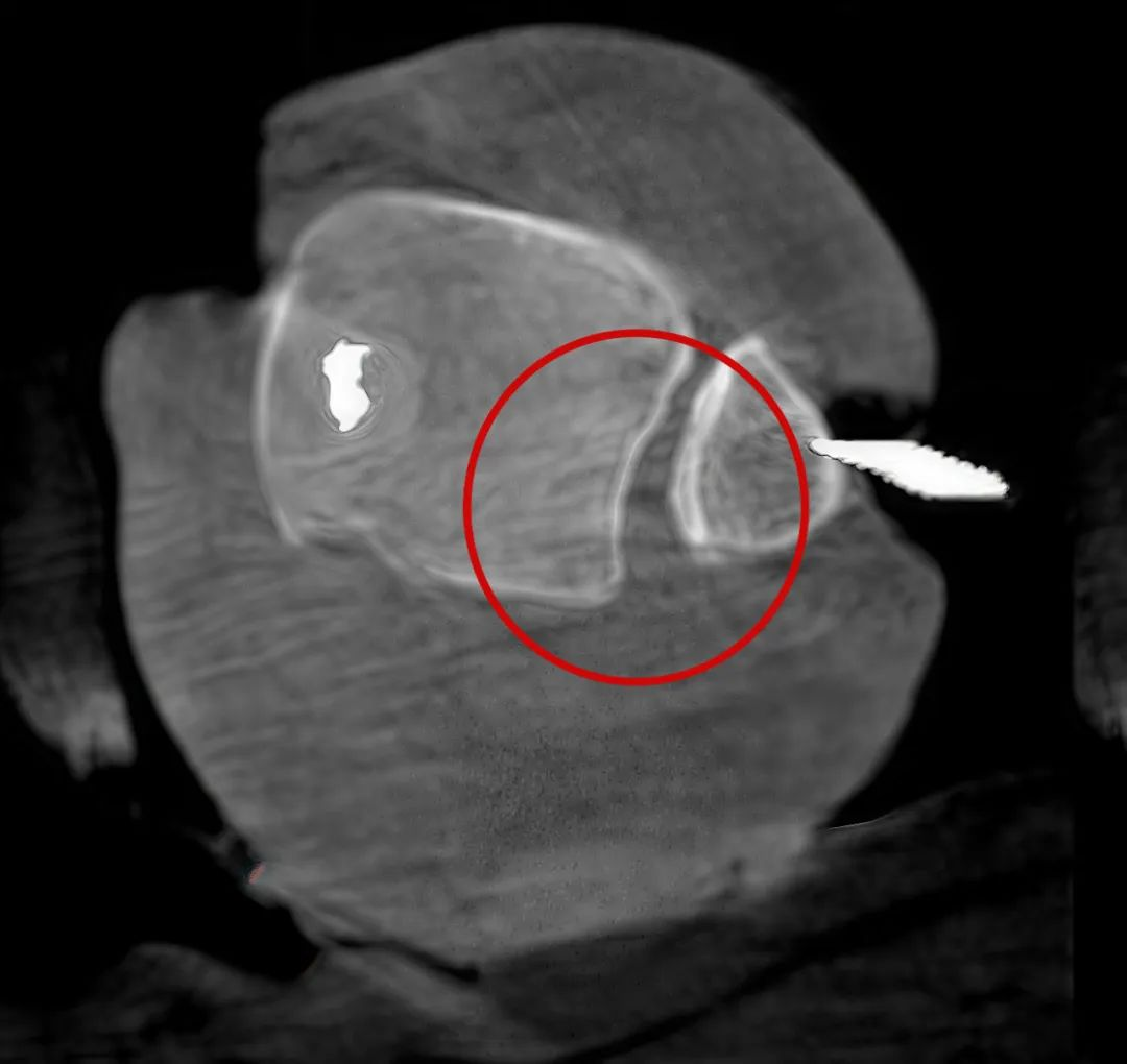 三维C形臂图像 三维C形臂图像