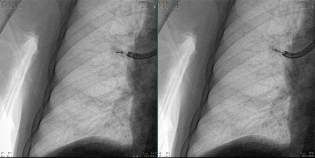 二维C形臂图像 二维C形臂图像